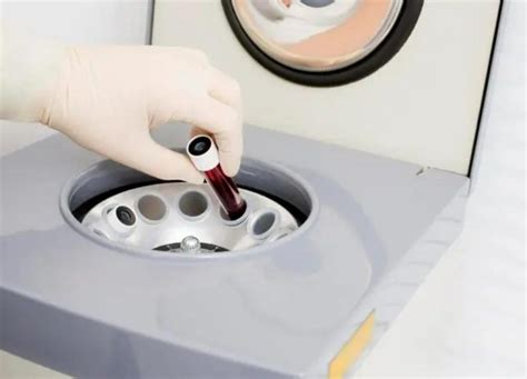 The Pivotal Role of Centrifuges in Blood Bank - Drawell - wintechmobiles.com
