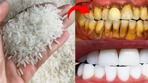 The secret dentists are hiding from us: it whitens teeth and removes ... - balustradellc