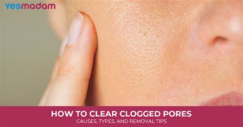 The Truth About Clogged Pores (And How to Clear … - balustradellc