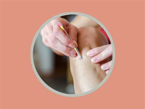 The Ultimate Guide to Preventing and Treating Ingrown … - balustradellc