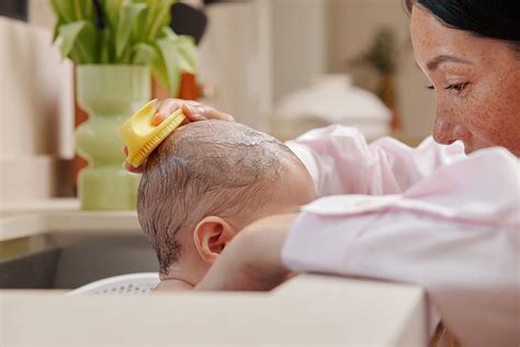 The Ultimate Guide to Treating Cradle Cap: Dos and … - balustradellc