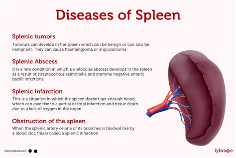 This disease can lead to inflammation and rupture of spleen and ... - Filo - balustradellc
