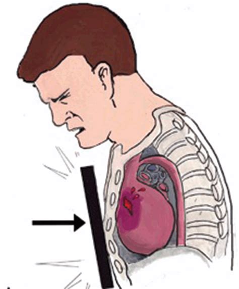 Thoracic trauma: Clinical and paleopathological perspectives - wintechmobiles.com