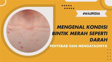 Timbulkan Bintik Merah - Muncul Benjolan, Ini 6 Cara … - balustradellc