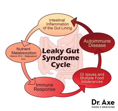 Timeframe to heal leaky gut - Medical News Today - balustradellc