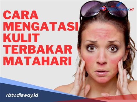 Tips Mudah Atasi Kulit Terbakar Matahari - Alodokter - balustradellc