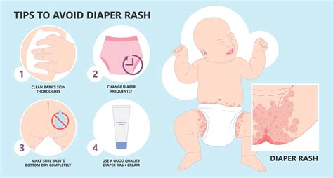 Tips to Prevent and Avoid Diaper Rash - balustradellc