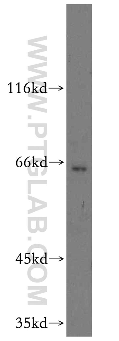 TM7SF3 Polyclonal Antibody (19826-1-AP)