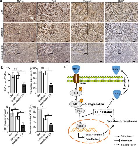 TNF-α is a potential therapeutic target to overcome sorafenib