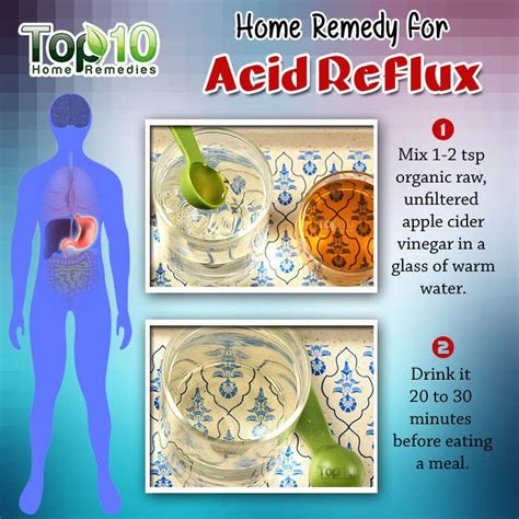 Top 10 Natural Remedies for Acid Reflux and GERD - balustradellc