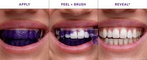 Transform Your Smile with Purple Whitening Strips - balustradellc