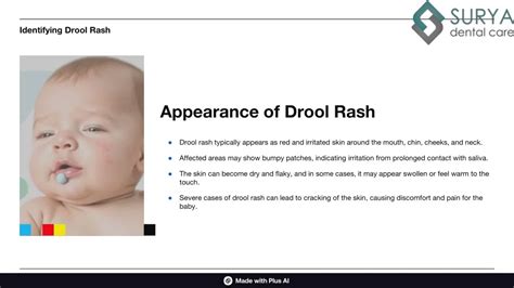 Treating Drool & Dribble Rash in Babies – My Expert Midwife - balustradellc