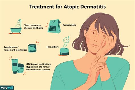 Treatment of atopic dermatitis (eczema) - UpToDate - balustradellc