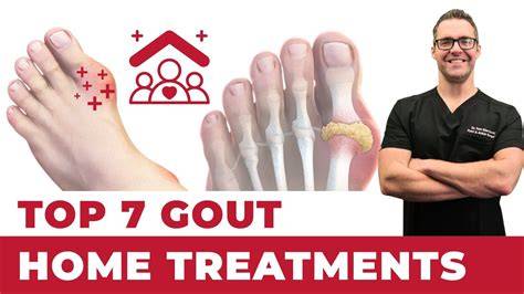 Treatments for Gout - Arthritis Foundation - raincitystudios.com