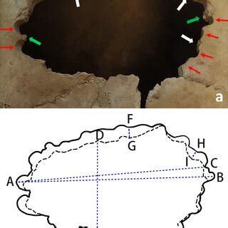 Trepanation in Ancient China - ScienceDirect - wintechmobiles.com