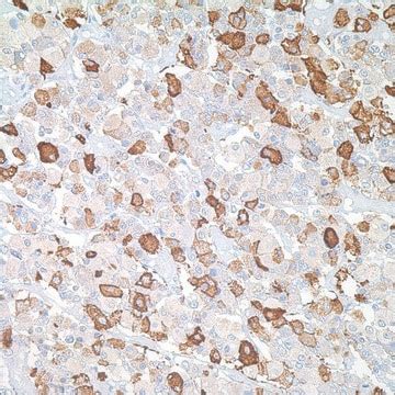 TSH Rabbit Polyclonal Antibody