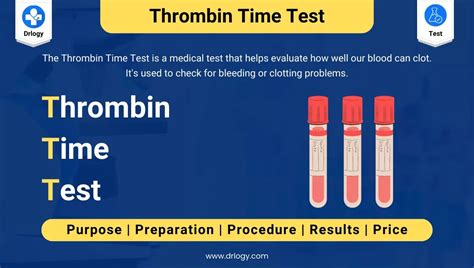 TT Test Thrombin Time Test Plasma Thrombin Time Test Thrombin