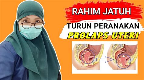 Turun Peranakan - Gejala, Penyebab, dan Pengobatan – Alodokter - wintechmobiles.com