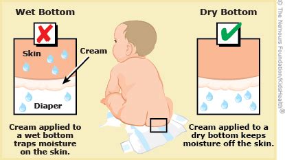 Types of Diaper Rash: Pictures, Causes, Treatment, Prevention - balustradellc