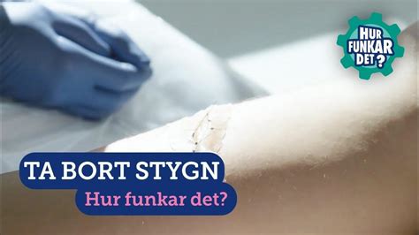 Ta bort stygn själv