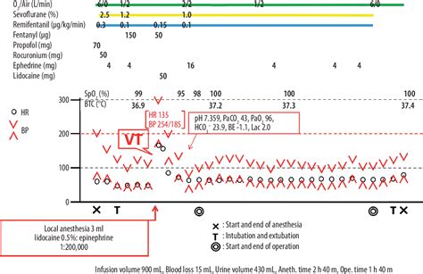 Takotsubo Cardiomyopathy Induced by Very Low-Dose …