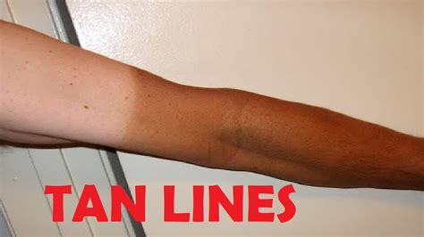 Tan Line Onlyfans Leak