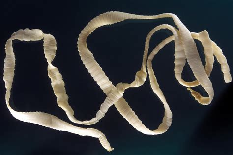 Tapeworms (Cestodes) Causes, Symptoms, and …