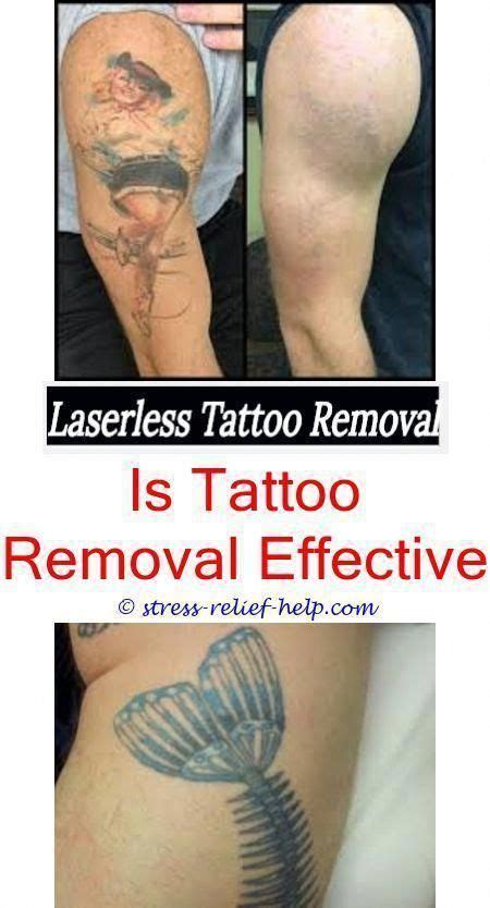 Tattoos removal near me. There are many available tattoo removal methods, but providers who specialize in professional tattoo removal generally agree that laser tattoo removal, like … 