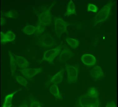 Tau CELL LINES - tau 2N4R (P301L) SHSY5Y CELL LINE