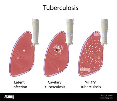 Tb parts. Things To Know About Tb parts. 