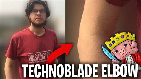Mar 7, 2017. #19. technoblade has fake elbows, it's clearly demonstrated by the curving shape leading up to his wrist. however, this a flaw that most people take for granted. technoblade could easily be from planet "Mbinguni Vita", where the inhabitants (called เนิร์ด) looked like the animals we call "pigs".. 