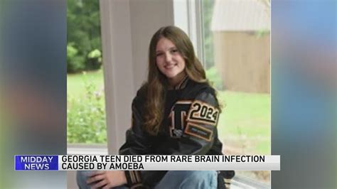 Teen dies from rare brain infection after swimming in Georgia, coroner rules