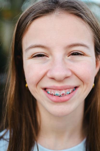 Teen girl braces naked. .  <a href=https://dmcf.me/assets/images/hvyazj...