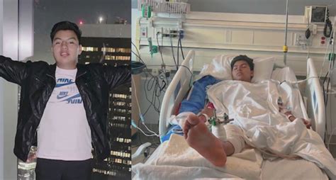 Teen loses leg after suspected drunk driver crashes into him at California bus stop