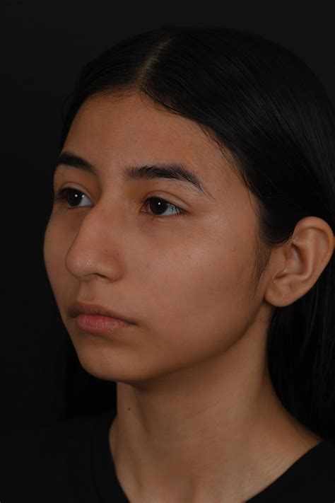 Teen poses gallery.  The Surgeon General&rsquo;s Call to Action To Prevent and Reduc...