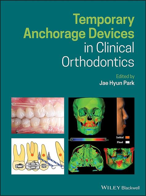 Full Download Temporary Anchorage Devices In Clinical Orthodontics By Jae Hyun Park
