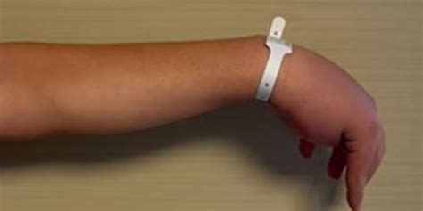 Tendon Transferleri El Cerrahi.