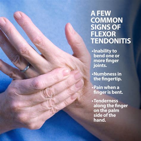 Tendonitis Hand - Causes & Best Treatment Options in 2024