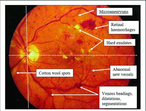 Tennessee retina. Things To Know About Tennessee retina. 