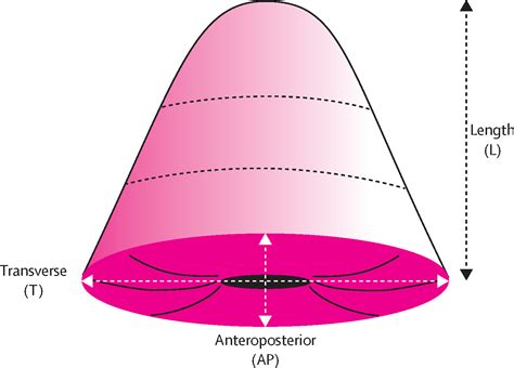 Terminology for cone dimensions after local conservative …