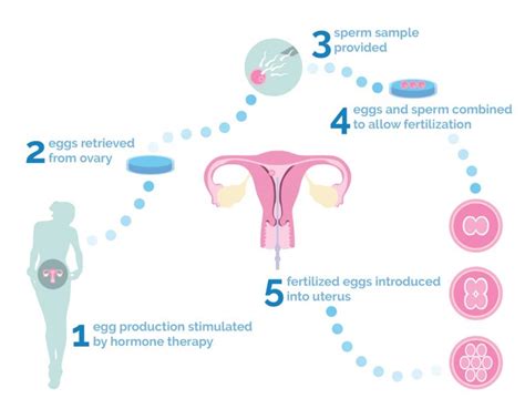 Test Tube Baby Process Diagram