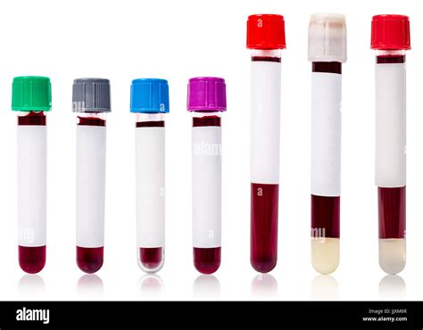 Test Tube Blood Sample Image & Photo (Free Trial) Bigstock