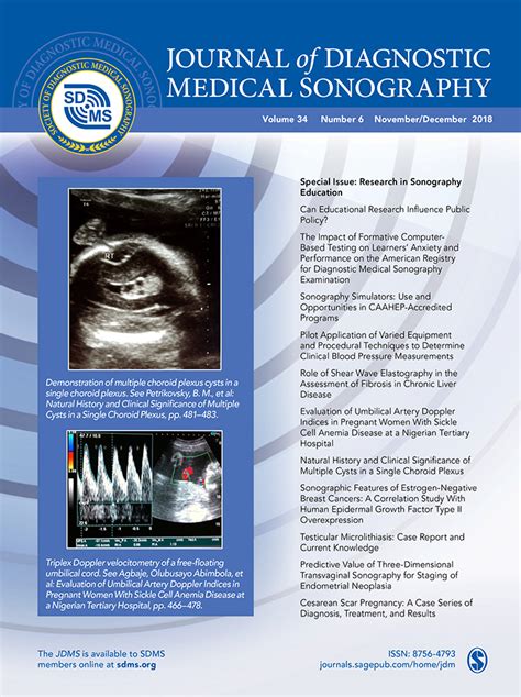 Testicular Microlithiasis: Case Report and Current Knowledge