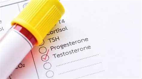 Testosteron Hormonu Seviyesi Ölçümü İçin Yapılan Test