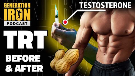 Testosterone Replacement Therapy (TRT) - PeakPerforMAX