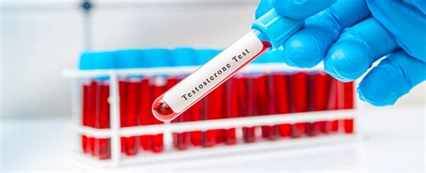 Testosterone Testing Is Completely Bogus