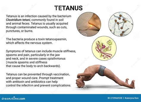 Tetanus: Causes, Symptoms, Treatments And More - Lybrate