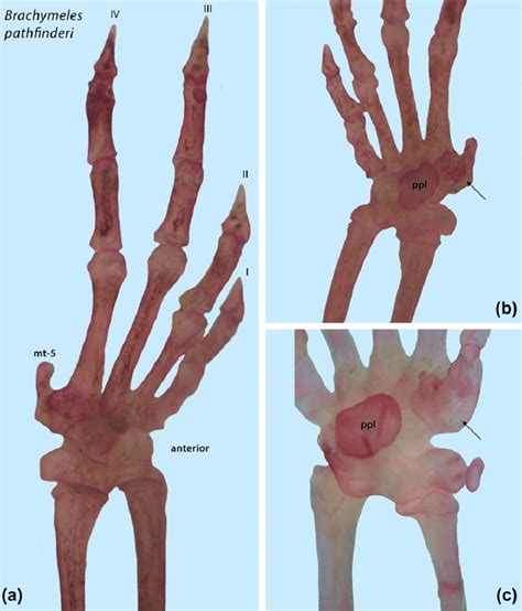 In the more derived tetradactyl groups (tayassuids, tragulids, and early camelids), the proximal volar metacarpal process becomes flatter and joints of the digit become more ginglymal in comparison with the less derived tetradactyl groups (ticholeptine and merychyine oreodonts, leptomerycid traguloids, prim. 