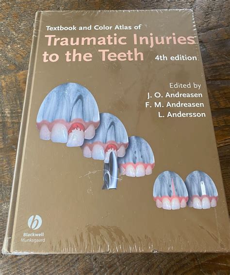 Textbook and color atlas of traumatic injuries to the teeth by jens o andreasen. - Study guide for criminal justice nocti exam.