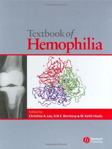 Textbook of hemophilia textbook of hemophilia. - Dual language development disorders a handbook on bilingualism second language learning second edition cli.